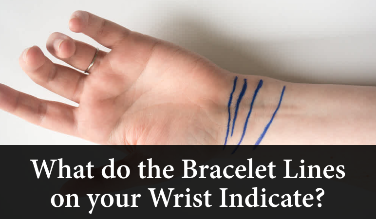 What do the bracelet lines on your wrist indicate?